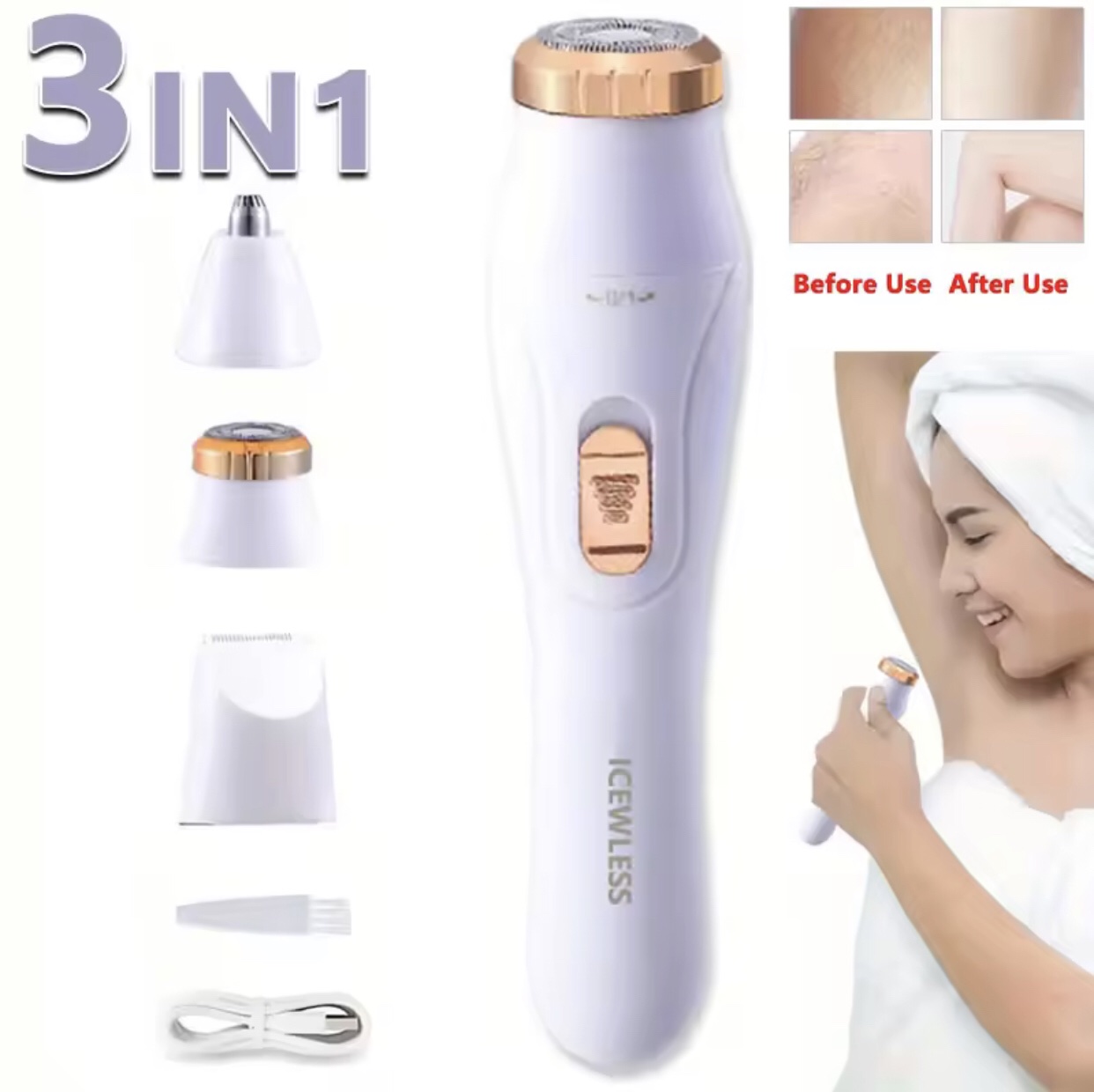 3IN1 ELECTRIC
